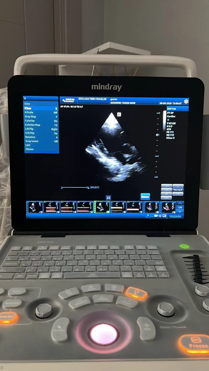 Ultrason ve ekokardiyografi